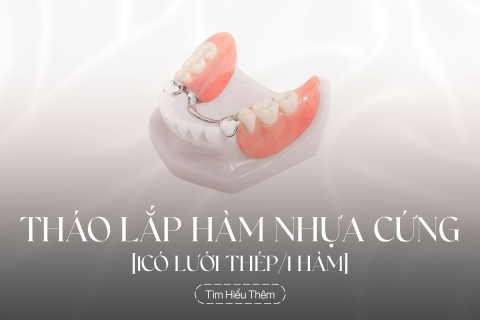 Tháo lắp hàn nhựa cứng có lưới thép